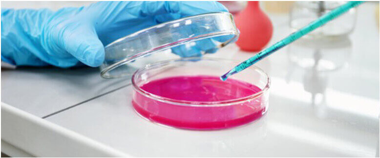 Chloro Alkyl Amines